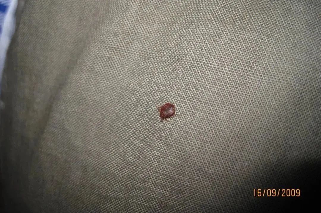 灭臭虫杀虫剂_杀虫剂杀臭虫有效果吗_杀臭虫药剂