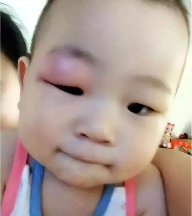 家庭最有效灭蚊子方法_家庭最有效的灭蚊方法_家庭灭蚊子最有效的方法是什么