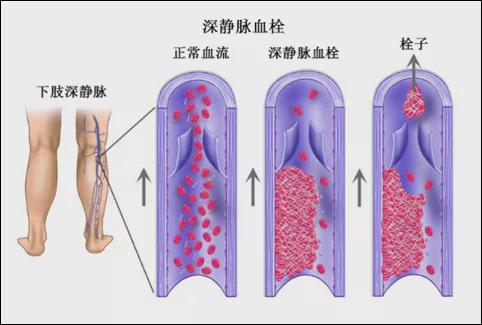 灭老鼠药_灭老鼠的药哪种比较好_老鼠药灭鼠效果